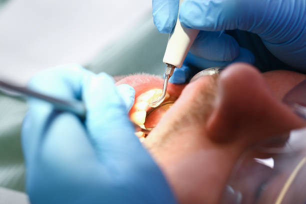 Best Emergency Broken Tooth Repair in Marriott Slaterville, UT