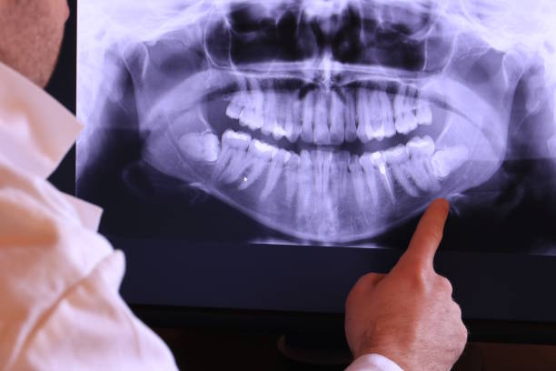 Best Emergency Wisdom Teeth Removal in Marriott Slaterville, UT