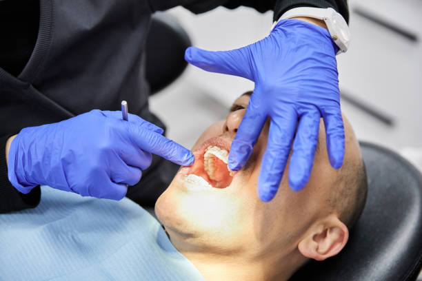 Best Emergency Tooth Extraction in Marriott Slaterville, UT